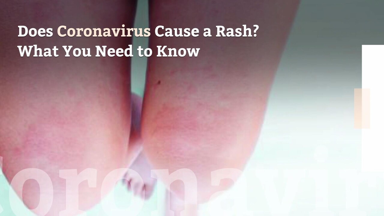 Does Coronavirus Cause A Rash What You Need To Know Health Com