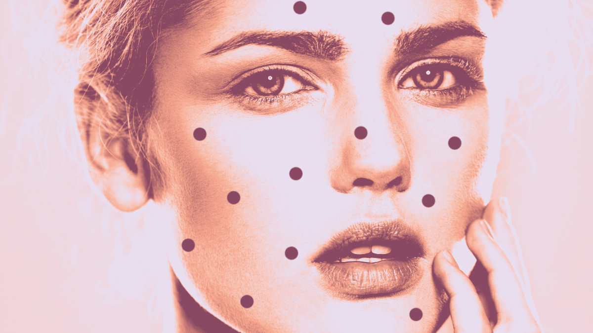 The 3 Most Common Types of Acne, and How to Treat Each