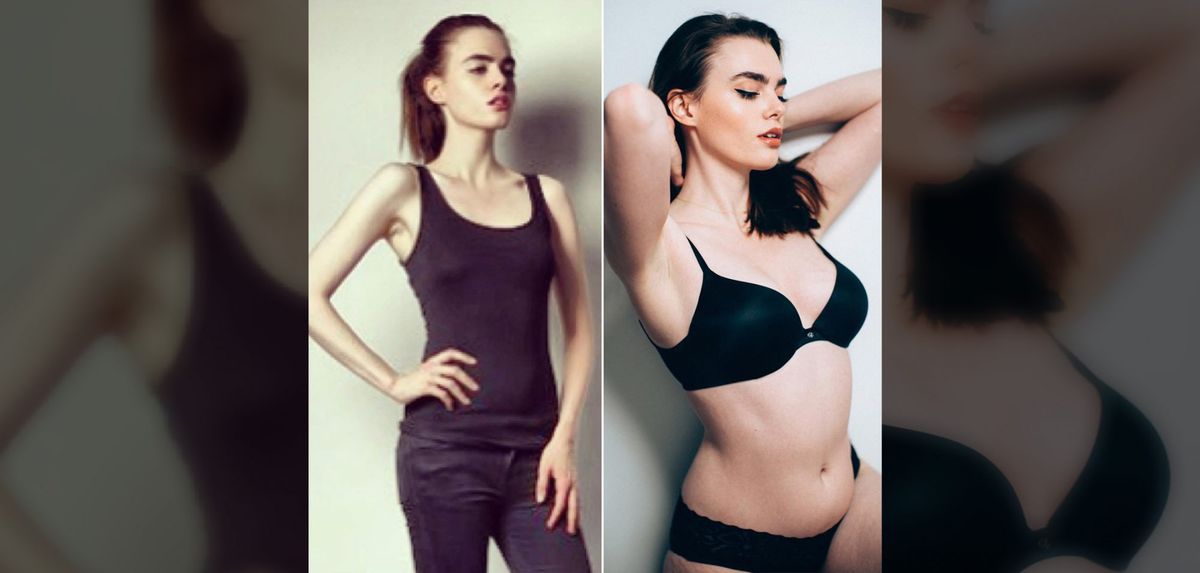 This Model Shared a Powerful Post About Overcoming an Eating Disorder to Love Her Body