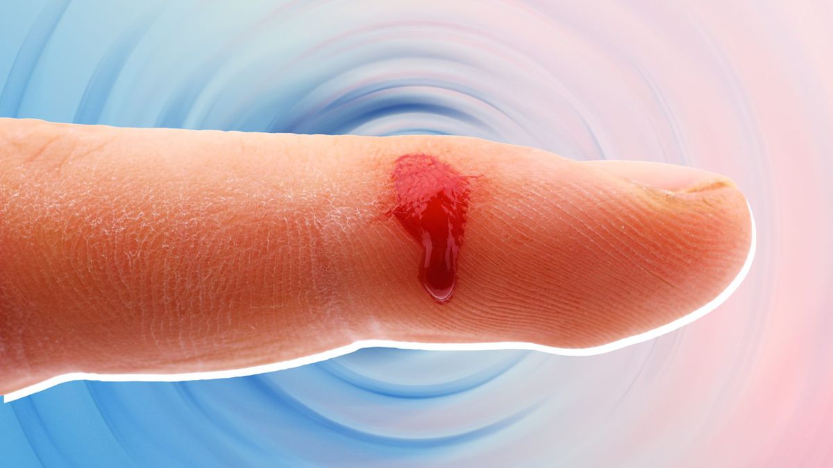 Here's How to Tell if You Have an Infected Cut—And What to Do About It