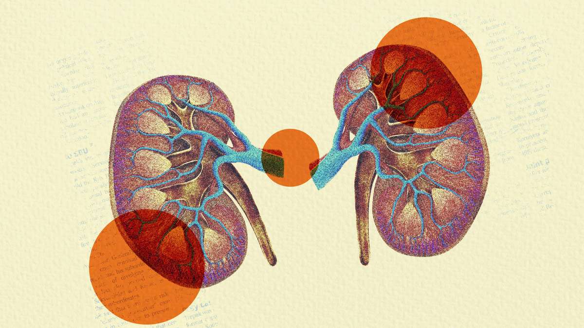 7 Signs That You Might Have Kidney Disease