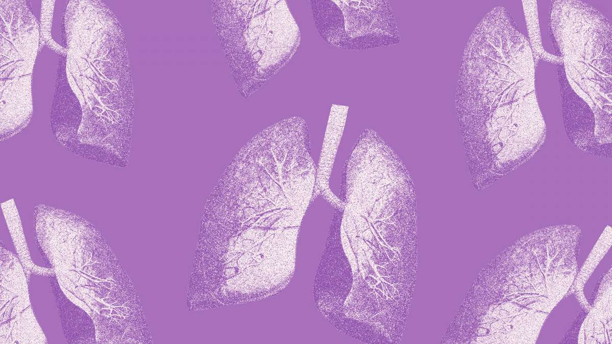 The 6 Different Types of Pneumonia, Explained by Doctors