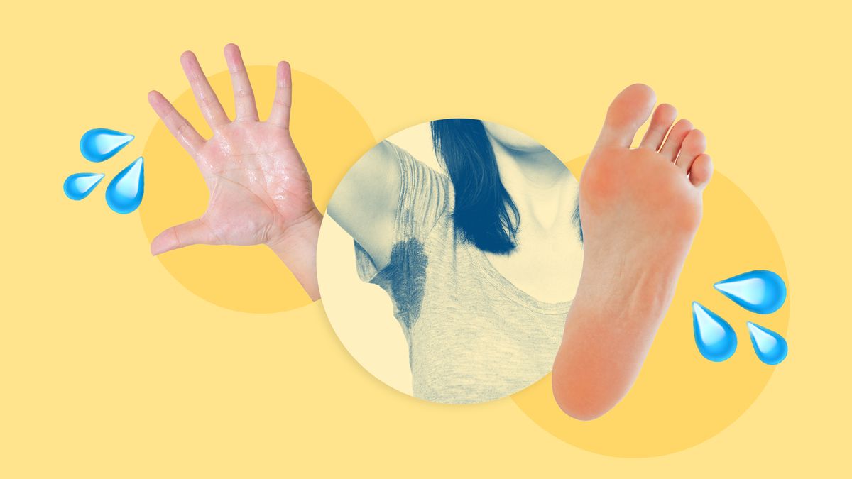 Sweaty Hands, Armpits, or Feet May Be a Sign of the Chronic Skin Condition