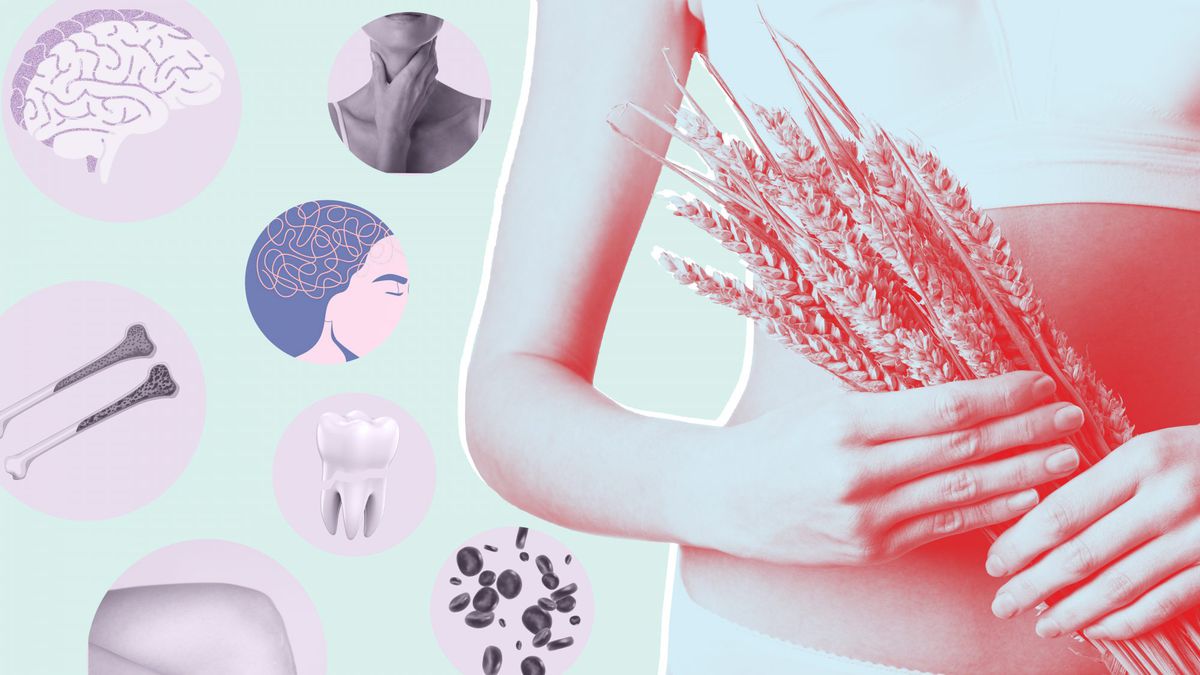 These Are the 10 Celiac Disease Symptoms You Need to Know, Experts Say