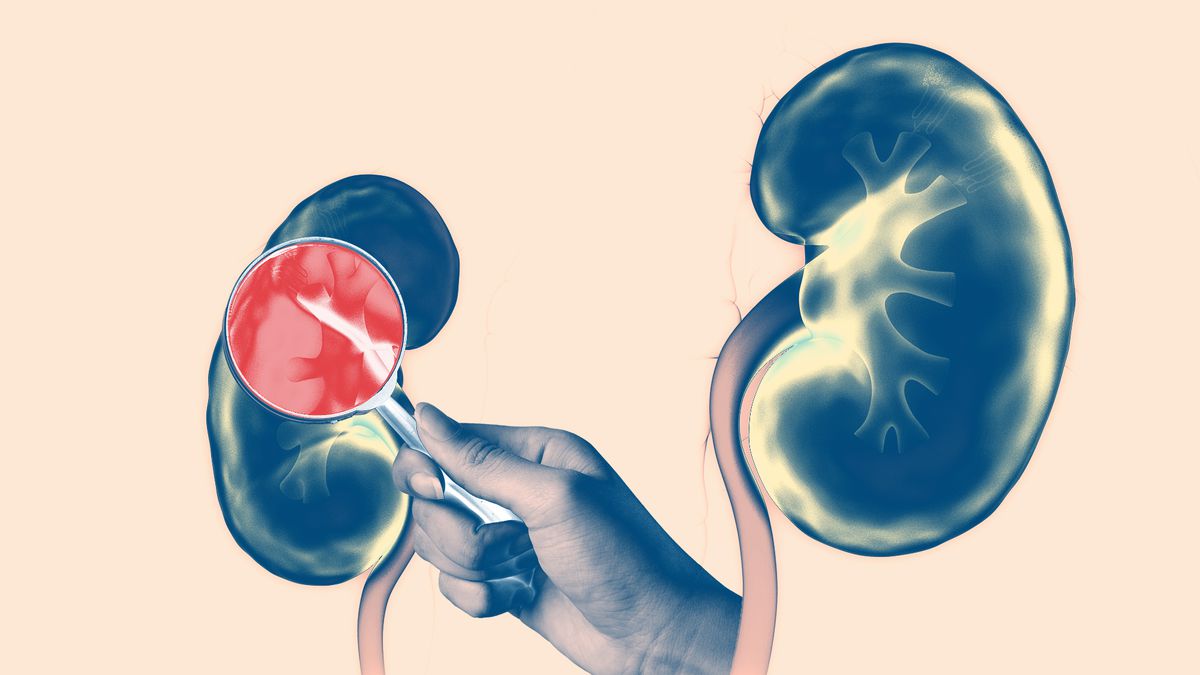 These 5 Conditions Can Damage Your Kidneys, and 2 of Them Are Extremely Common