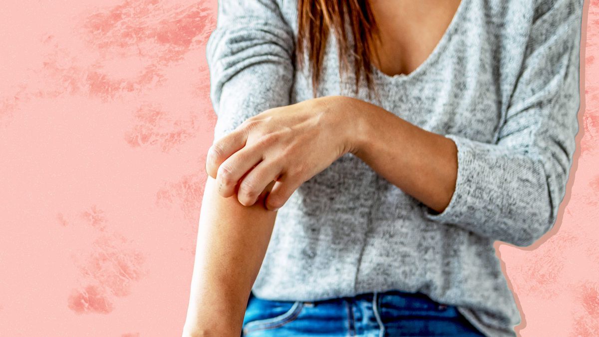 4 Plaque Psoriasis Symptoms: What It Looks and Feels Like, According to Experts