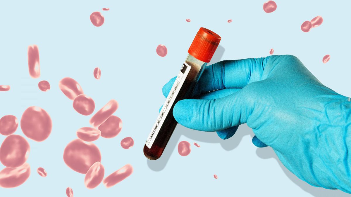 A New Blood Test Has Been Shown to Detect More Than 50 Types of Cancer—But Who Can Get It Right Now?