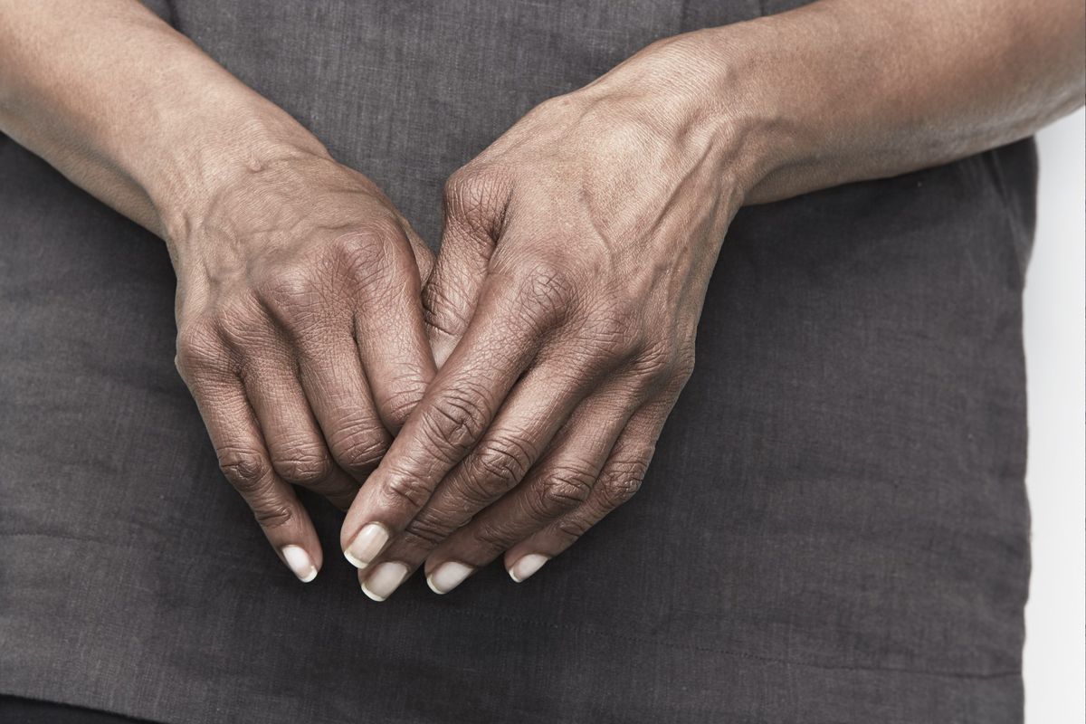 5 Things You Need to Know About Rheumatoid Arthritis