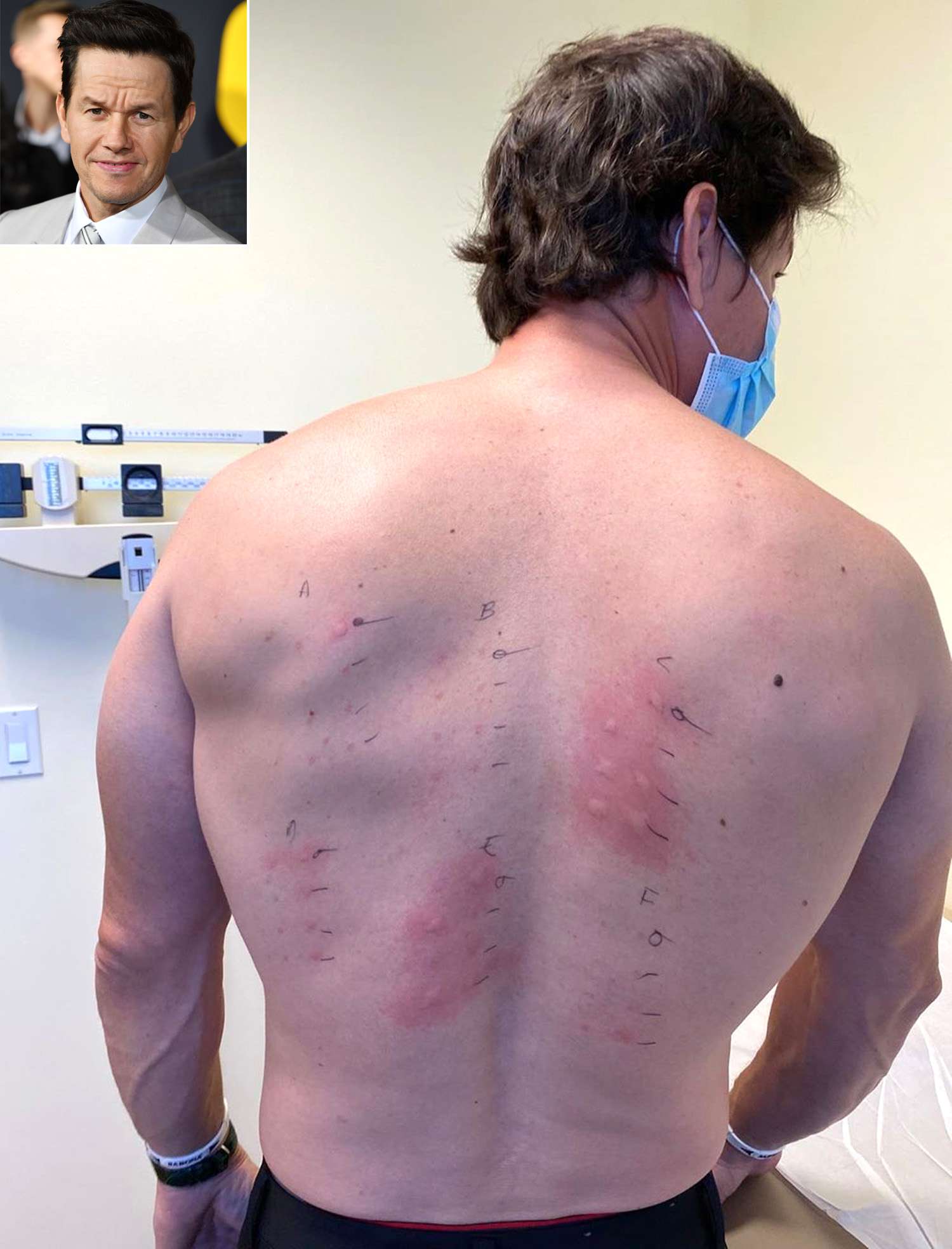 Mark Wahlberg Shares Allergy Test Results After Learning He's 'Allergic to Almost Everything' - PEOPLE