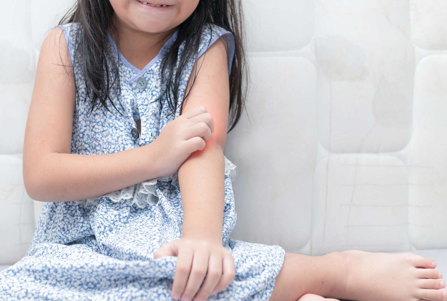 Skin Rashes In Children Learn The Most Common Causes Parents
