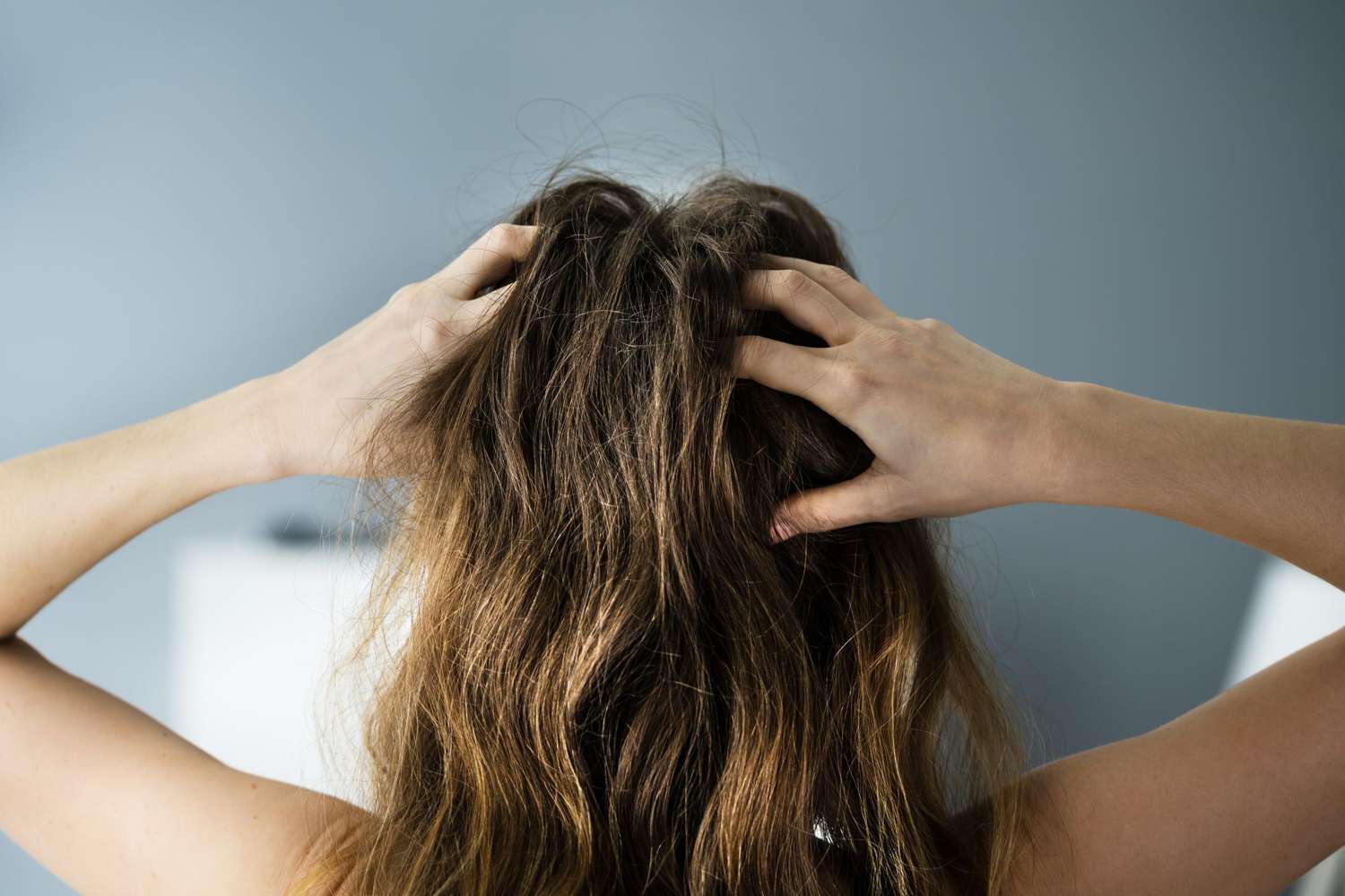 How to Treat Hair Loss at the Crown | Martha Stewart