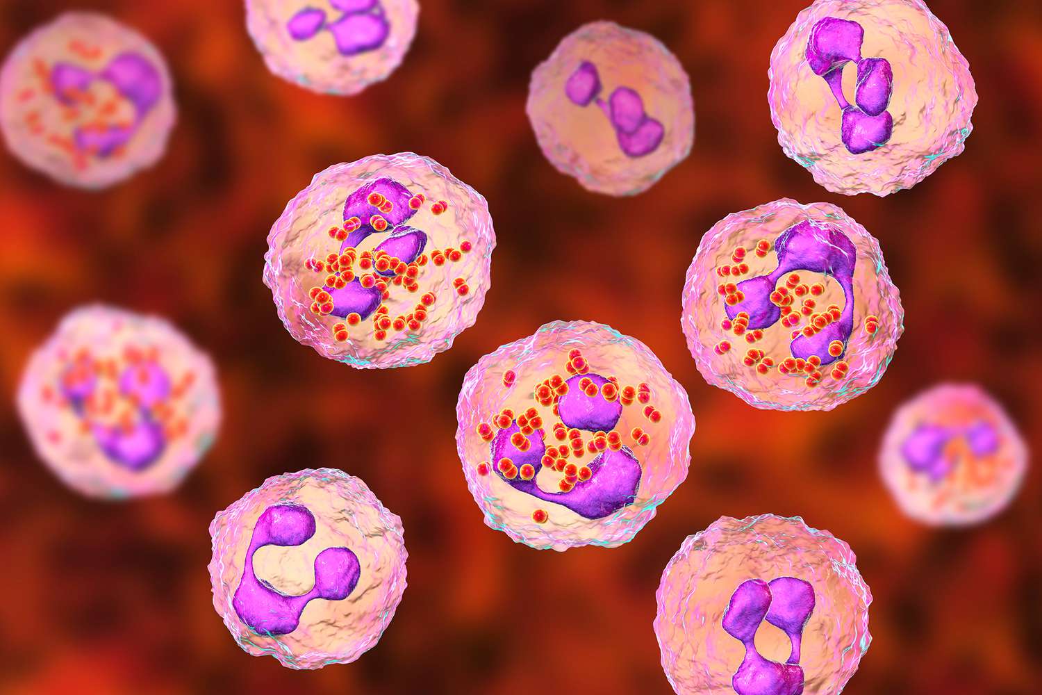 6 Dead amid Meningococcal Disease Outbreak Affecting Gay and Bisexual Men in Florida: CDC