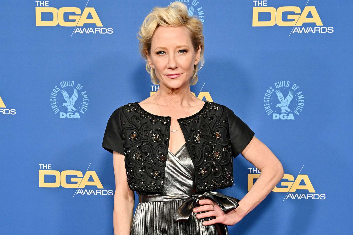 Anne Heche reportedly hospitalized after fiery car crash