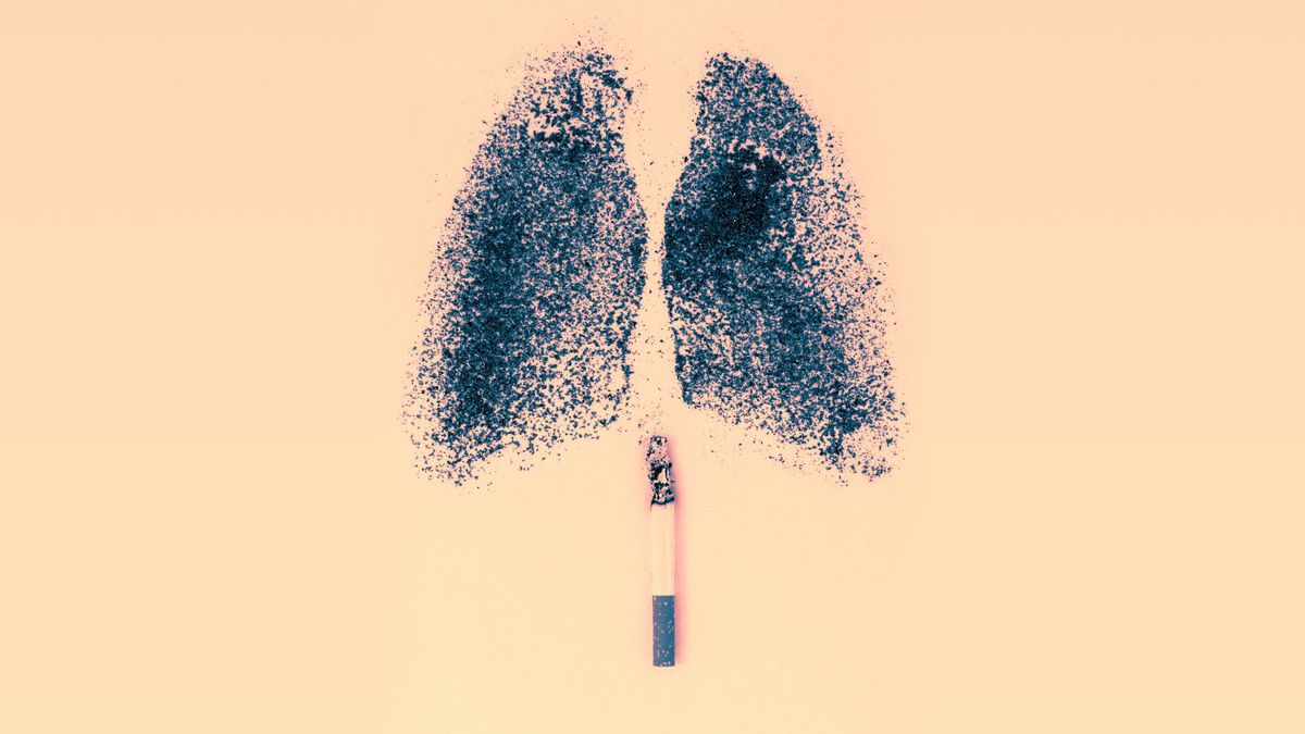 Lung Cancer and COPD Turned This Person's Lungs Completely Black