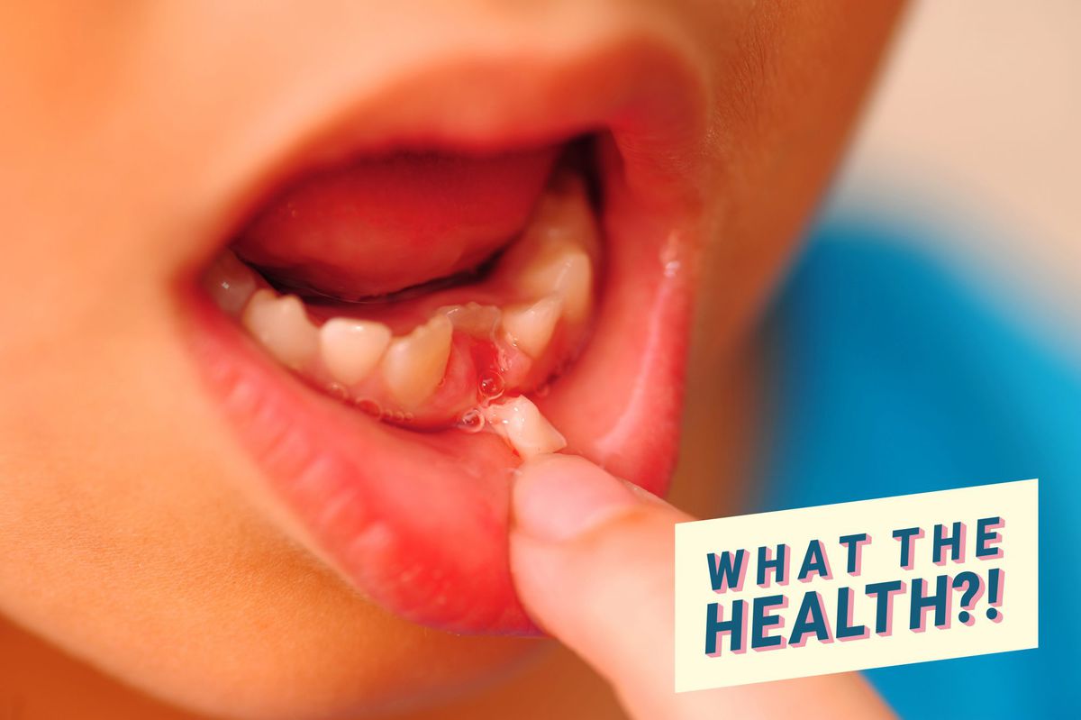 Can You Inhale Your Tooth While Sleeping? Here's How It Sent One Girl to the Hospital