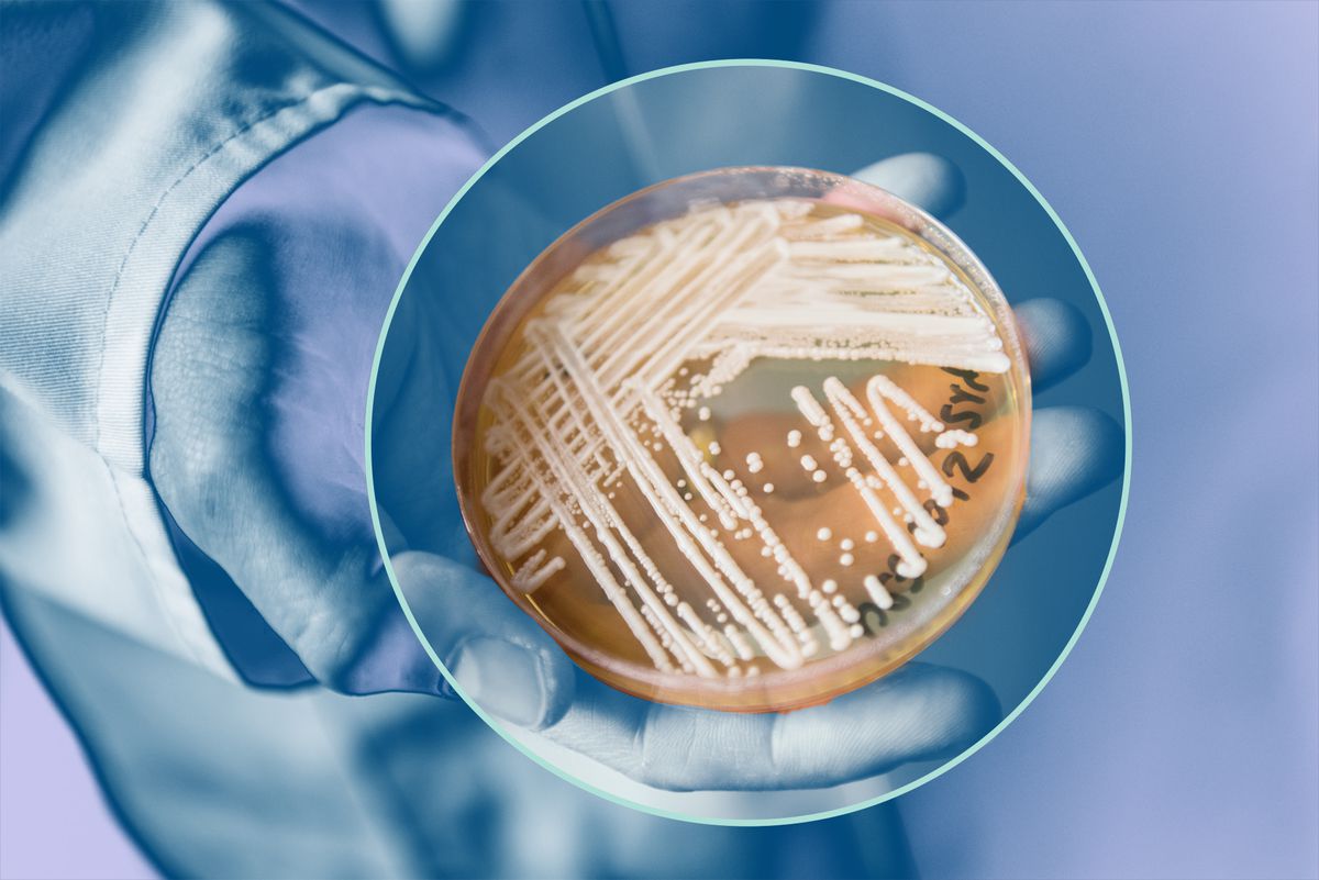 CDC Warns of 'Superbug' Fungus Candida Auris Outbreaks in 2 US Cities | Health.com - Health.com