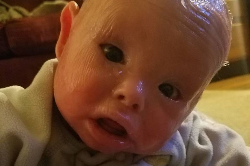 This Mom Has to Bathe Her Baby in Bleach Because He Has Such a Serious and Rare Skin Condition