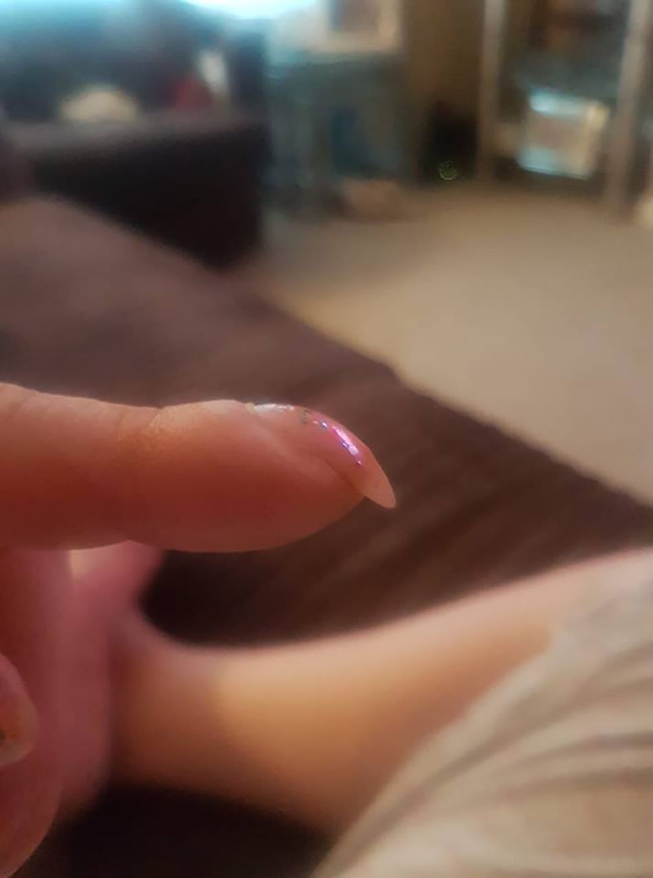 This Woman Posted a Photo of Her Curved Nail on Facebook&mdash;and Had 'No Idea' It Was a Sign of Cancer