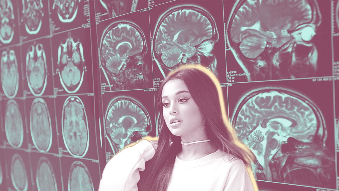 Ariana Grande Just Shared Her 'Terrifying' Brain Scan on Social Media