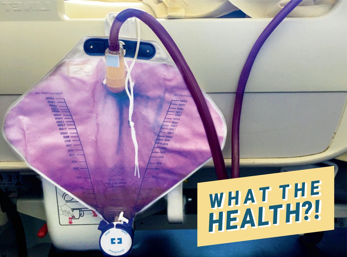 This Woman's Urine Turned Purple&mdash;and That's Actually More Common Than You'd Think