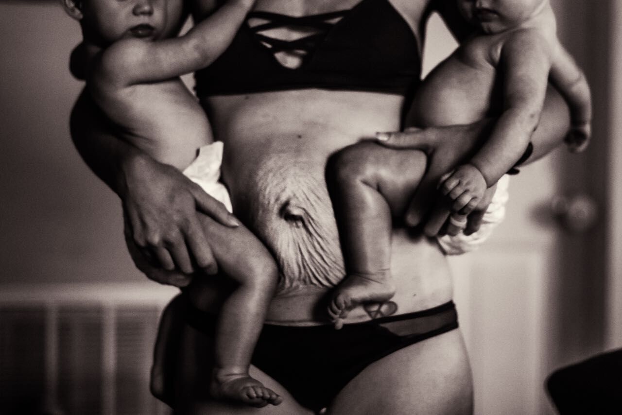 Real Photos Of Postpartum Bodies Show Reality Of Life After Birth Parents