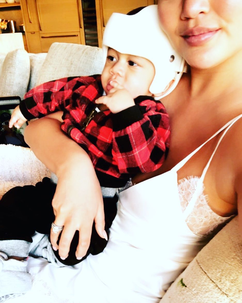 Chrissy Teigen Posted a Photo of Her 5-Month-Old Baby in a Helmet&mdash;Here's Why He's Wearing It