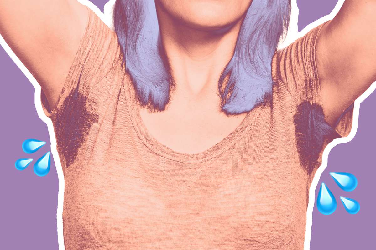 What to Do If You Have Excessive Armpit Sweating: Advice From Dermatologists