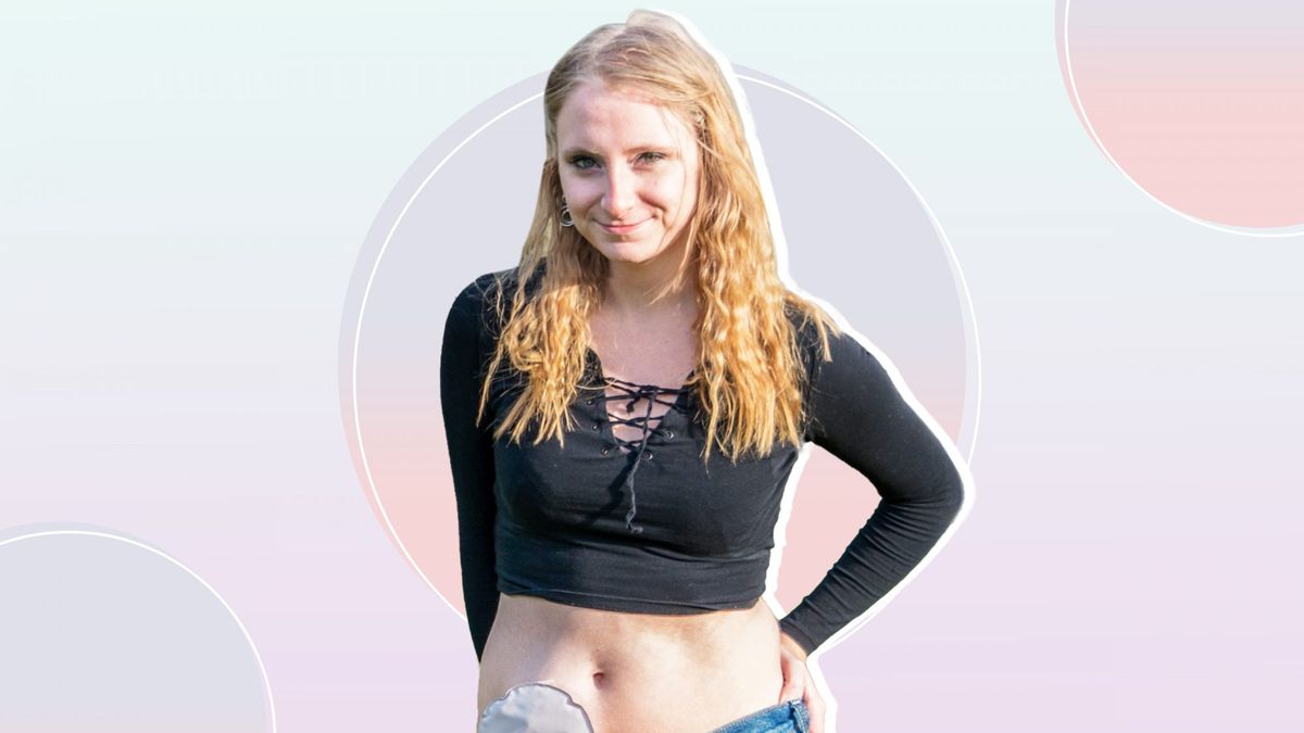 Influencer Shares Photos of Herself Walking Runway Show With Her Ostomy Bag on Full Display