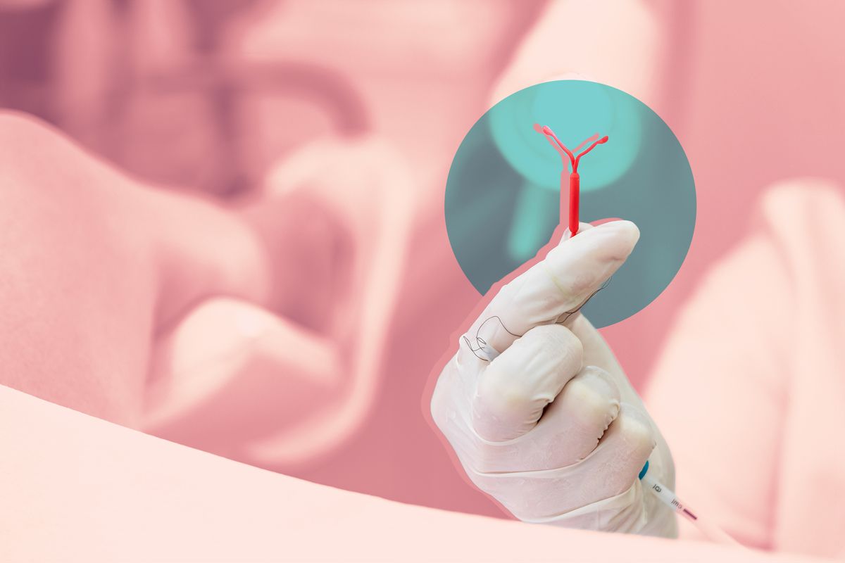 Everything You Need to Know Before Getting an IUD