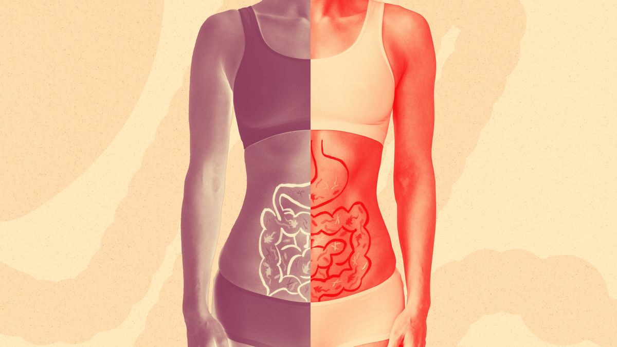 It's Important to Know the Difference Between Diverticulosis and Diverticulitis—Here's Why