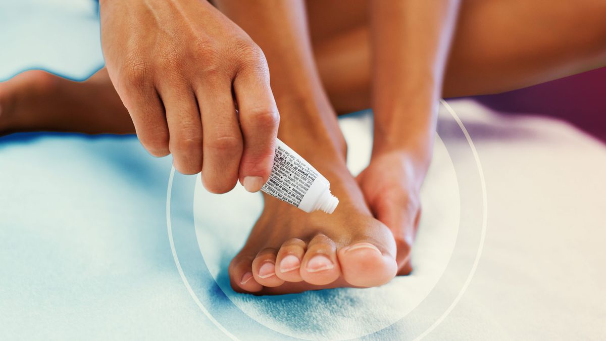 Podiatrists Say You Should Never Ignore Toenail Fungus—Here's Why