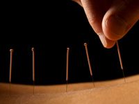 breast-cancer-acupuncture-200.jpg