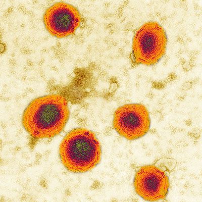 Pennsylvania: Measles