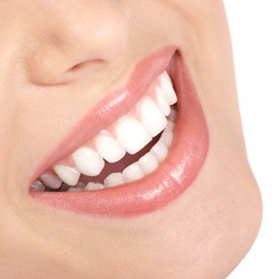 Teeth whitener