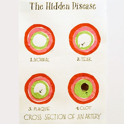 hidden-disease