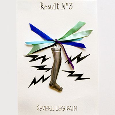 Result No. 3: Severe leg pain