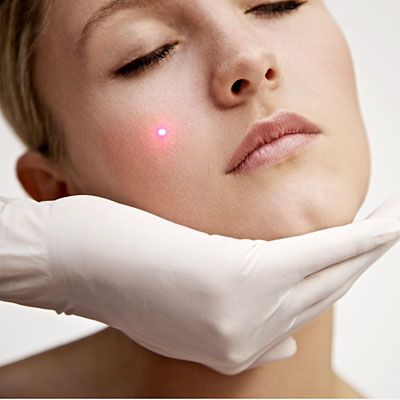 receiving-laser-treatment