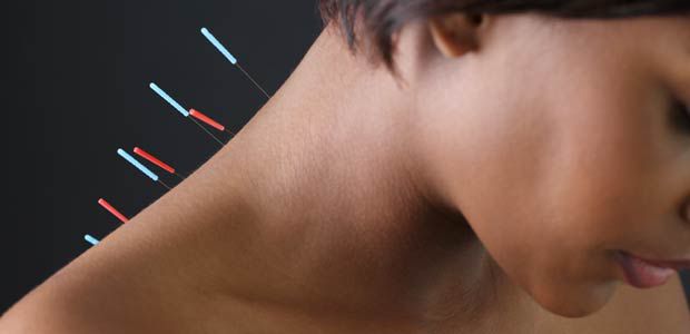 about-acupuncture-620.jpg
