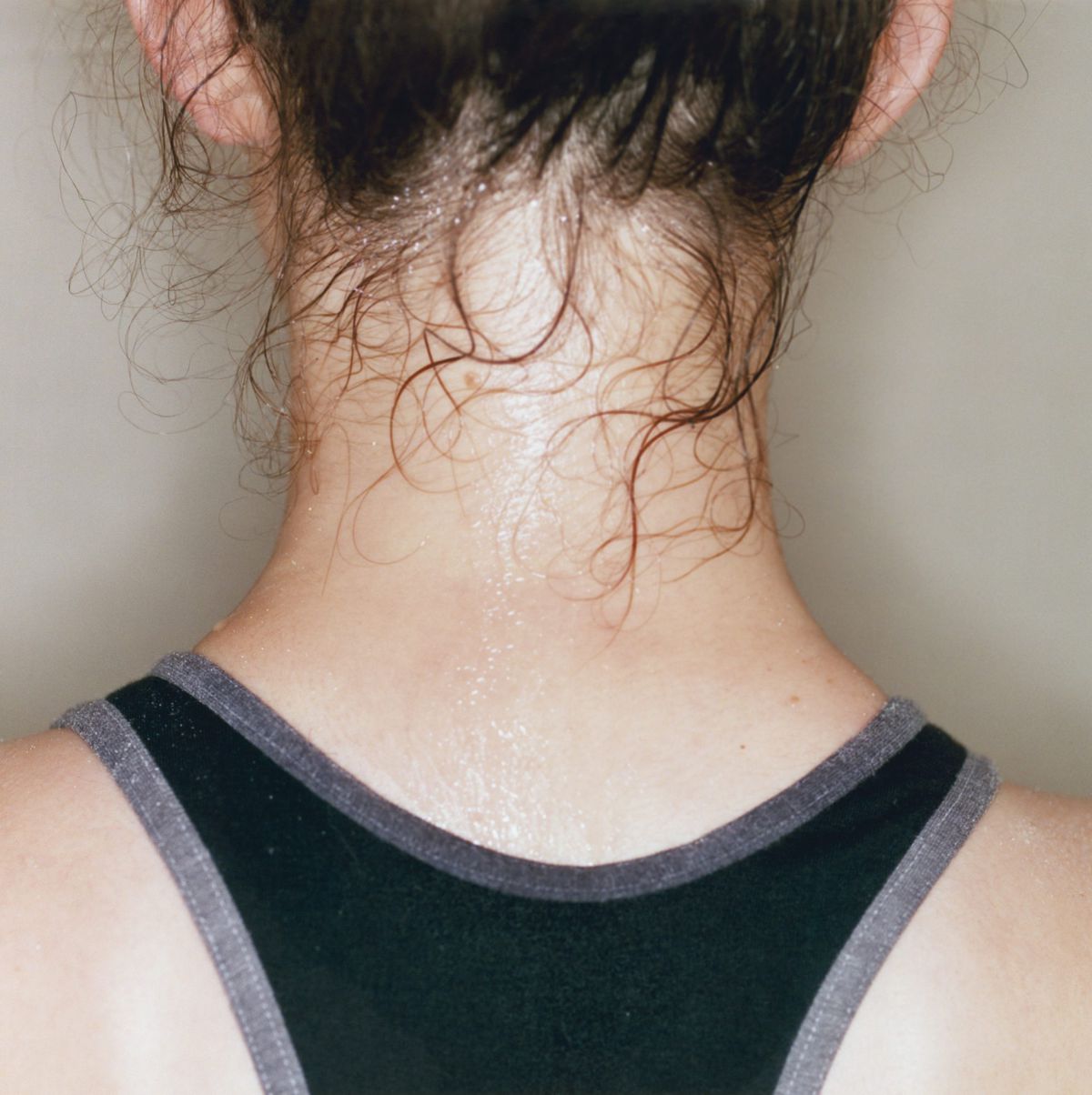 12-things- atopic-dermatitis-worse-sweating