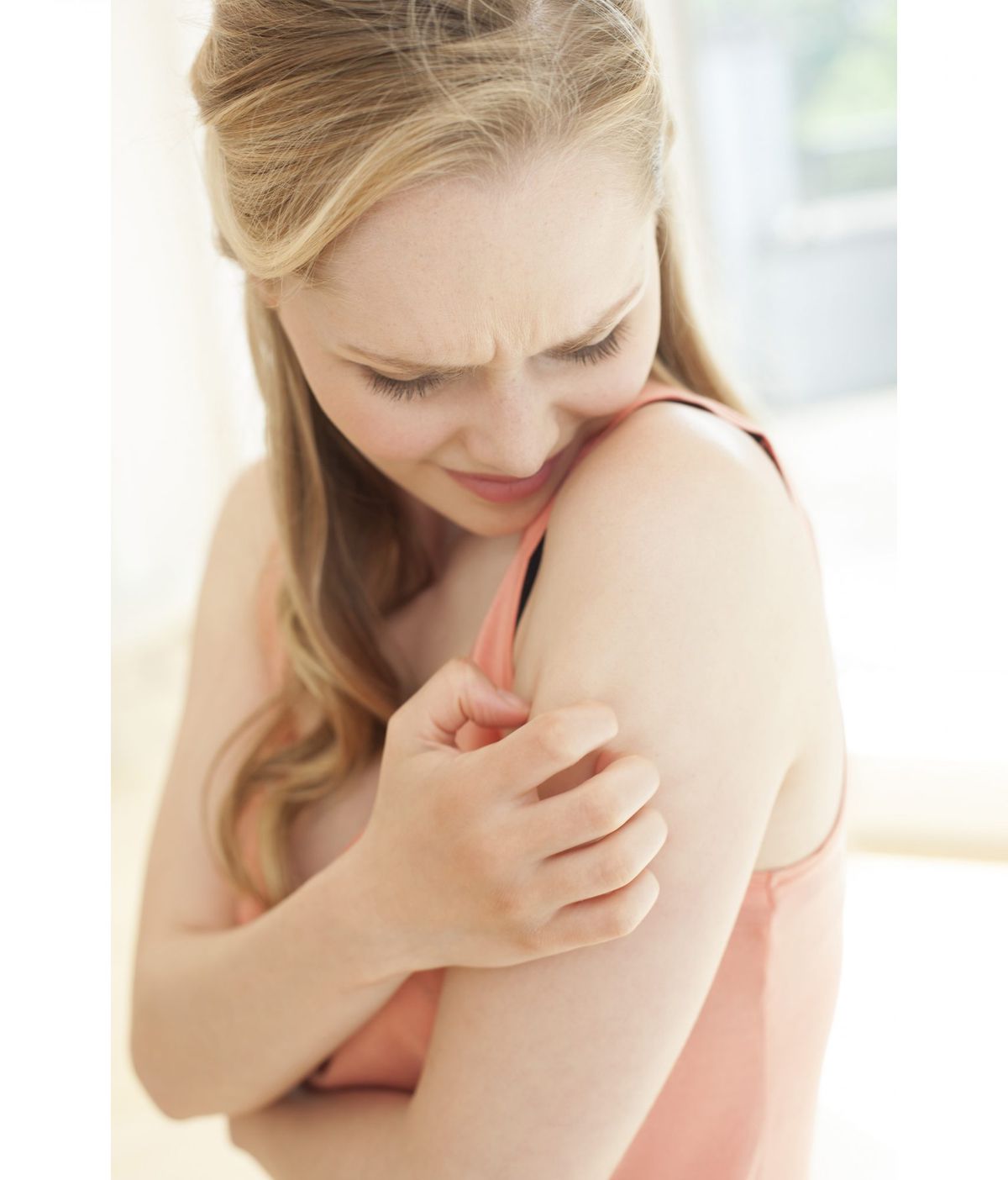 eczema-woman-itchy-arm