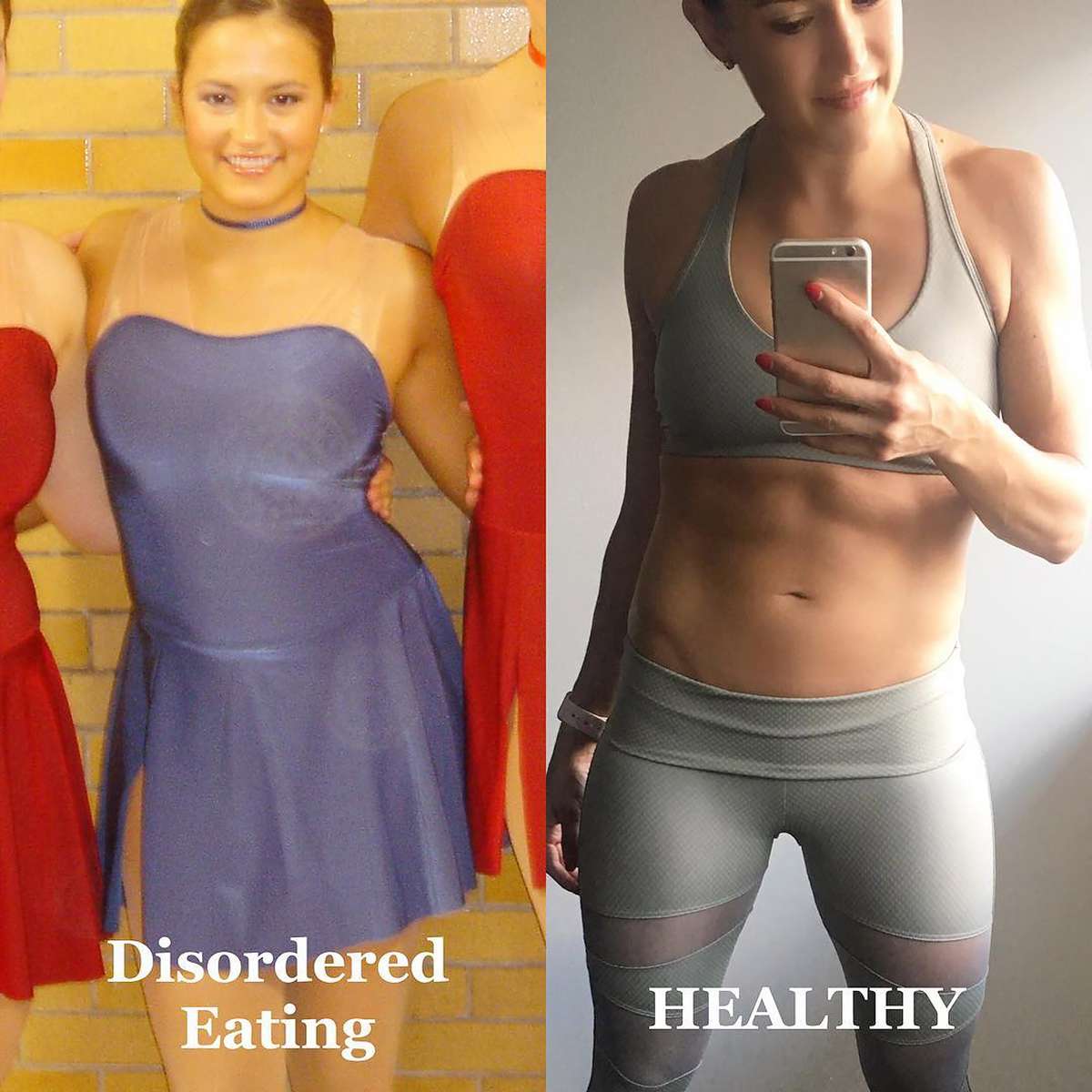 Anorexia Survivor Shows Disordered Eating Doesn’t Always Look 'Scary Skinny'