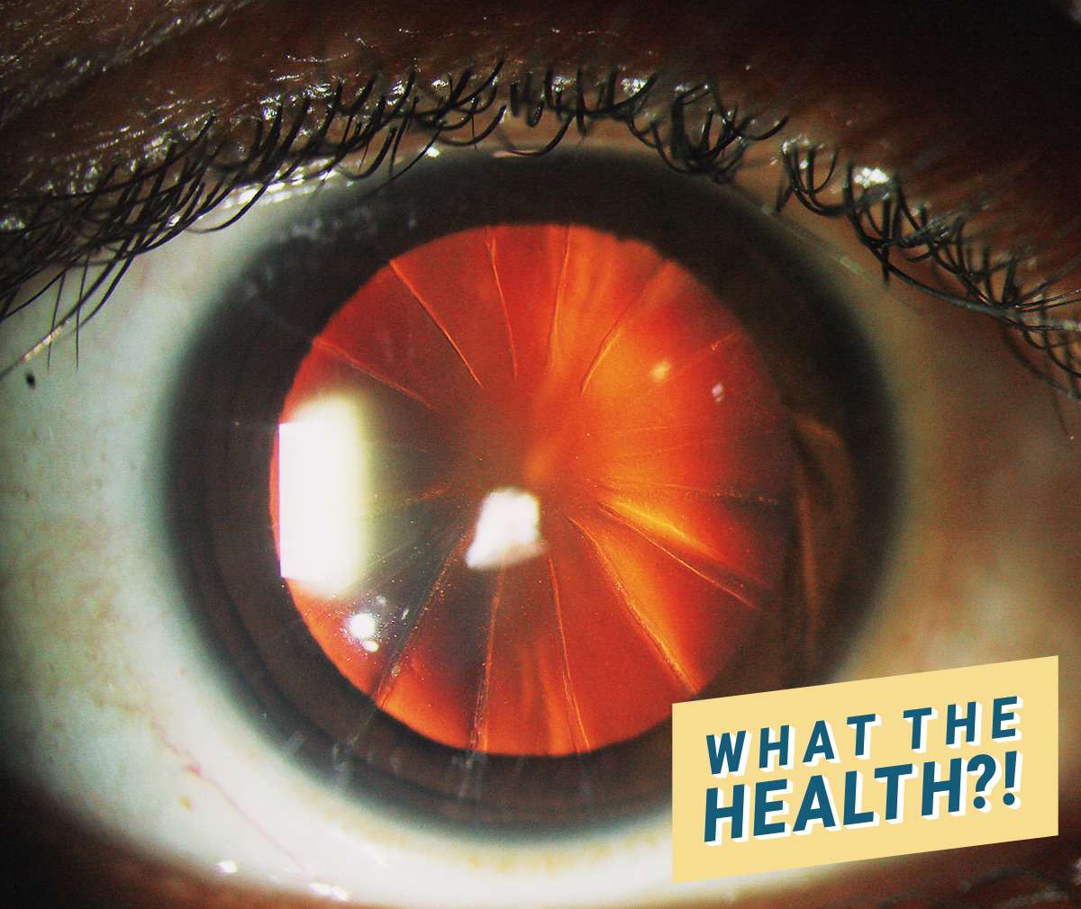 what-the-health-eye
