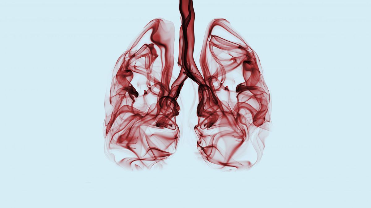 lung-cancer-survival lung-cancer survival cancer smoking health wellbeing