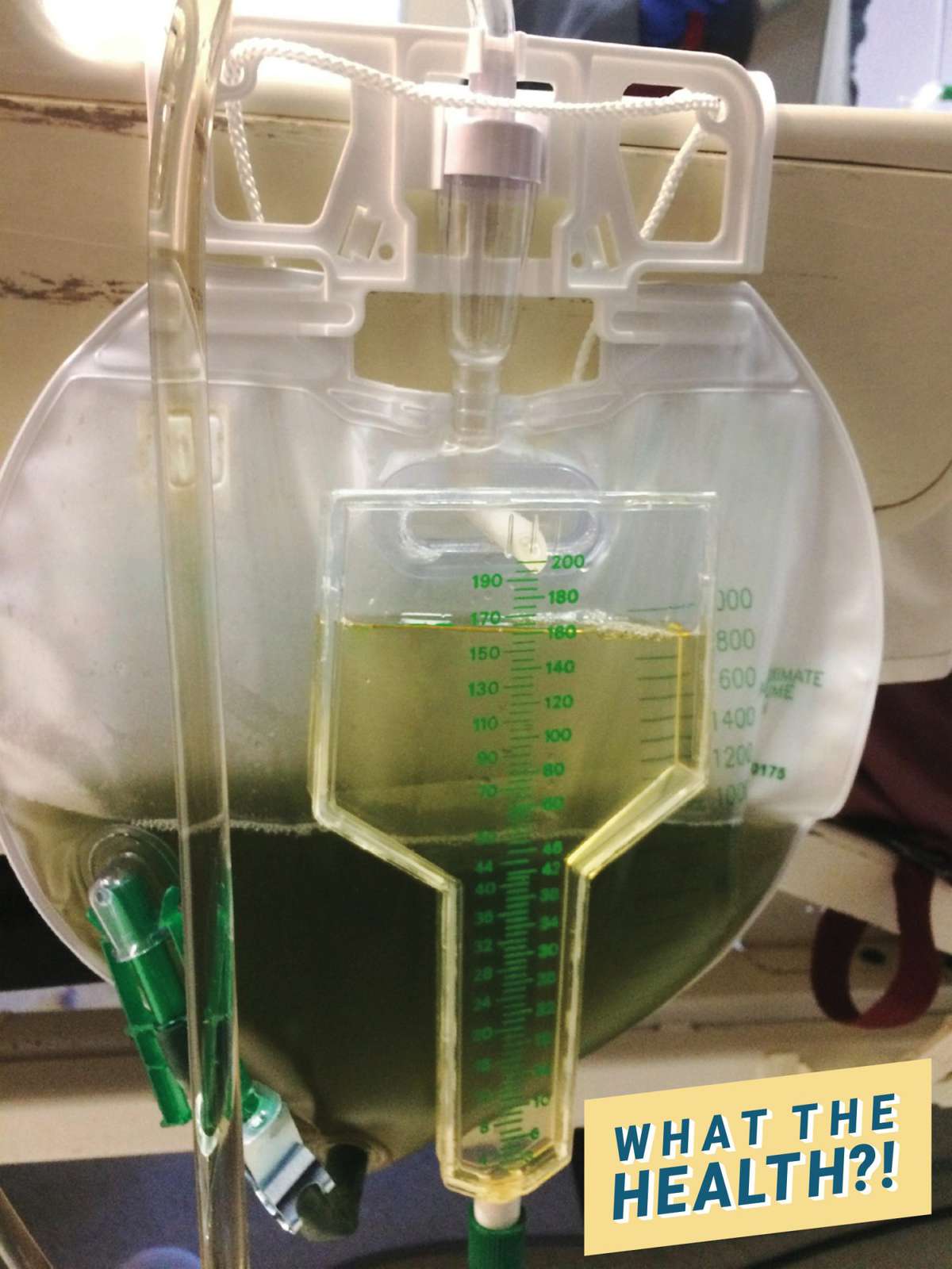 Green-Urine-WTH