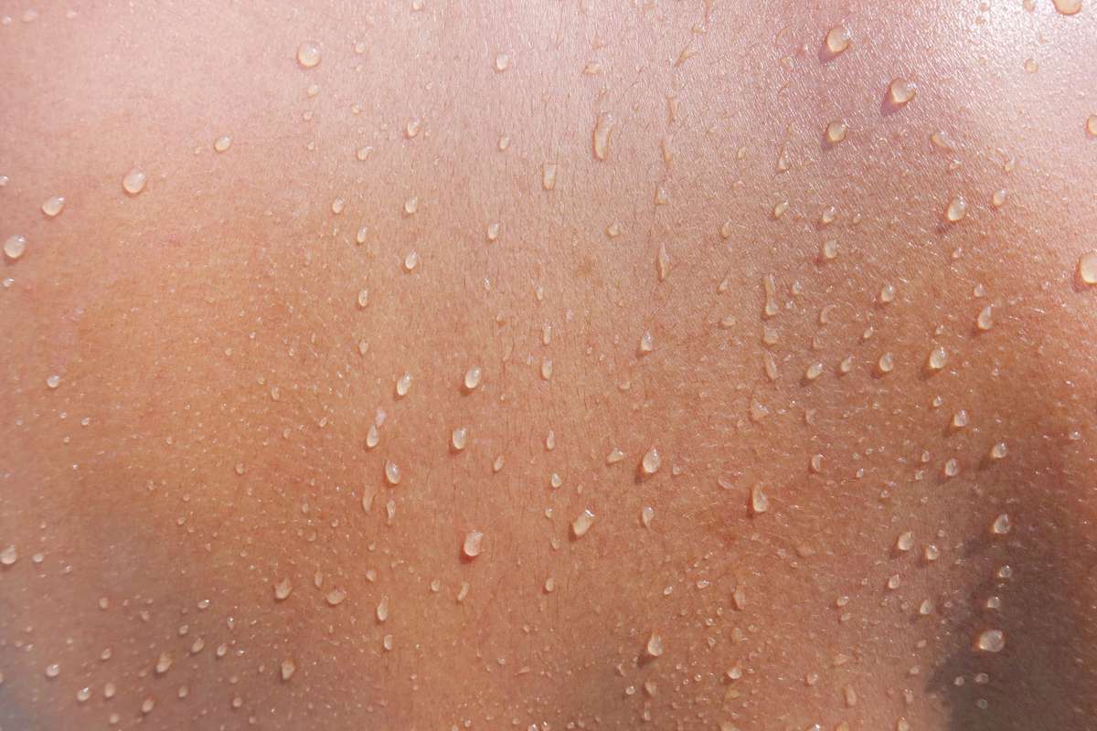 generalized hyperhidrosis , Water drops on woman skin, close up of wet human skin texture