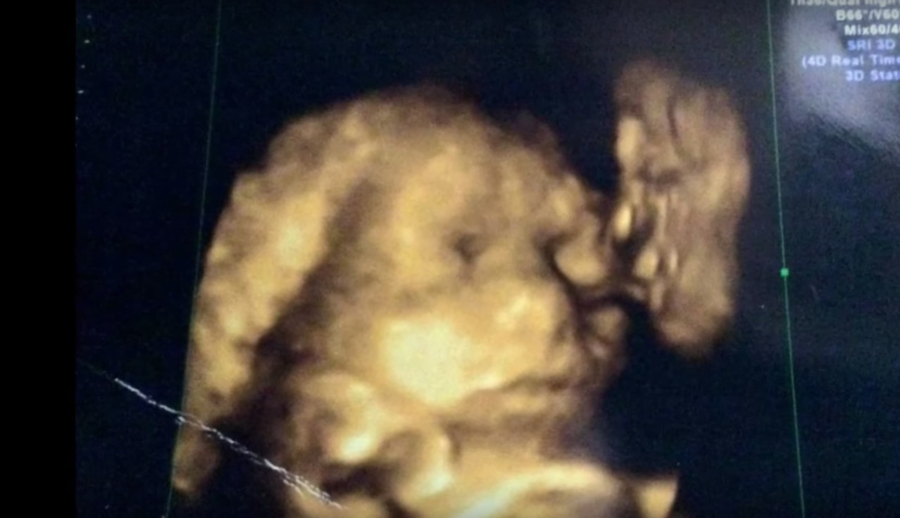 Picture of Dead Grandfather Kissing Baby in Ultrasound