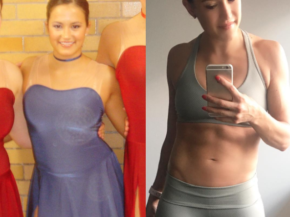 Image of Carissa Seligman before and after anorexia
