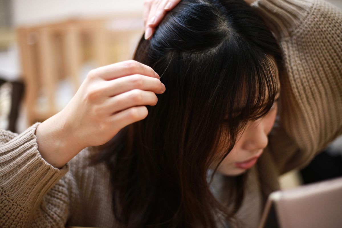 How To Manage an Acne-Prone Scalp
