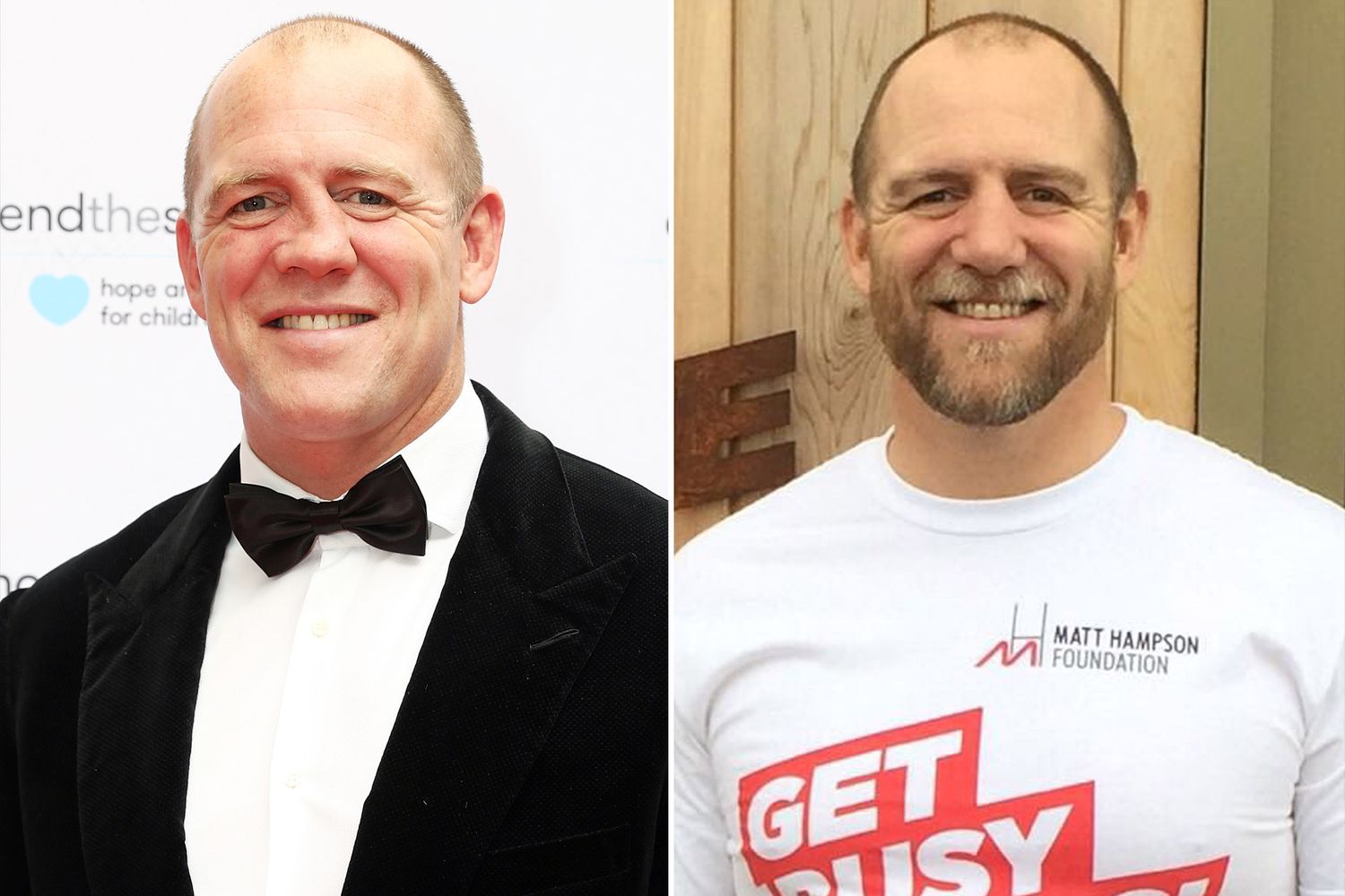 Mike Tindall Got His Famously Crooked Nose Fixed | PEOPLE.com