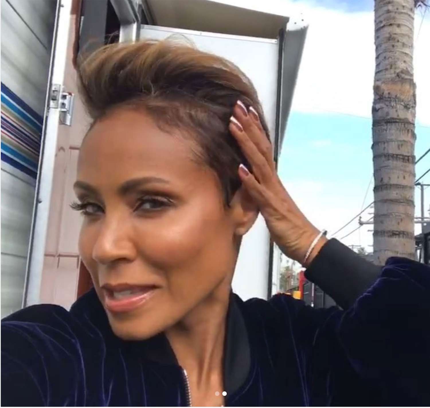 Jada Pinkett Smith Is Treating Her Hair Loss With Steroids They Seem To Be Helping People Com